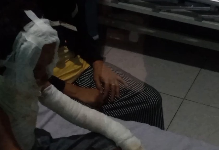 Ahsan Farid Trisnanto, bocah berusia 5 tahun yang terluka usai mengonsumsi es smoke. (Sariagri/Arief L)